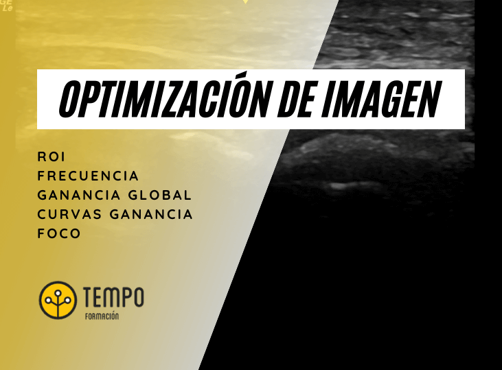 optimizacion-de-imagen-ecografia